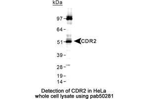 Image no. 2 for anti-Cerebellar Degeneration-Related Protein 2, 62kDa (CDR2) (C-Term) antibody (ABIN363590) (CDR2 抗体  (C-Term))