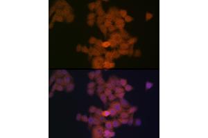Immunofluorescence analysis of HeLa cells using PFDN5 Rabbit mAb (ABIN1682853, ABIN3018535, ABIN3018536 and ABIN7101624) at dilution of 1:100 (40x lens). (PFDN5 抗体)