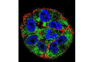 Confocal immunofluorescent analysis of p53 Antibody (S15) (ABIN390201 and ABIN2840688) with  cell followed by Alexa Fluor 488-conjugated goat anti-rabbit lgG (green). (p53 抗体  (AA 1-30))