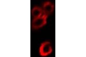 Immunofluorescent analysis of Alpha-enolase staining in Hela cells. (ENO1 抗体)