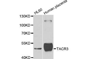 Western blot analysis of extracts of various cell lines, using TACR3 antibody (ABIN5975101) at 1/1000 dilution. (TACR3 抗体)