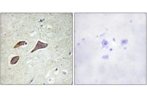 Immunohistochemistry analysis of paraffin-embedded human brain, using Nonvoltage-gated Sodium Channel 1 (Phospho-Thr615) Antibody. (Nonvoltage-Gated Sodium Channel 1 (AA 581-630), (pThr615) 抗体)