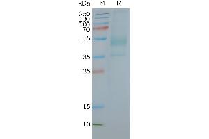 Human C-Nanodisc, Flag Tag on SDS-PAGE (CXCR2 蛋白)