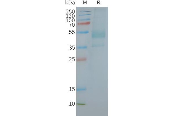 CXCR2 蛋白