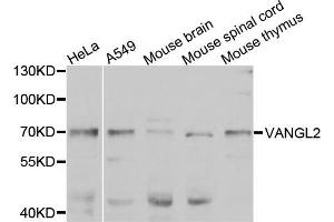 Western blot analysis of extracts of various cell lines, using VANGL2 antibody (ABIN5975655) at 1/1000 dilution. (VANGL2 抗体)