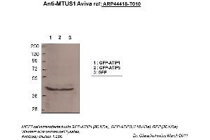 Image no. 2 for anti-Microtubule Associated Tumor Suppressor 1 (MTUS1) (N-Term) antibody (ABIN310597) (MTUS1 抗体  (N-Term))