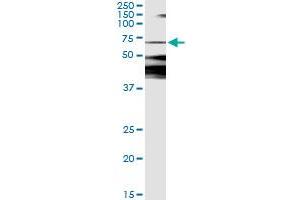 Immunoprecipitation (IP) image for anti-Calcium/calmodulin-Dependent Protein Kinase Kinase 2, beta (CAMKK2) (AA 1-130) antibody (ABIN564643)