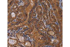 Immunohistochemistry (IHC) image for anti-Melanoma Antigen Family B, 10 (MAGEB10) antibody (ABIN2423757) (MAGEB10 抗体)