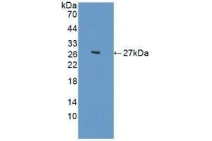 Detection of Recombinant CDH2, Human using Polyclonal Antibody to N-cadherin (NCAD) (N-Cadherin 抗体  (AA 50-276))