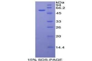 SDS-PAGE analysis of Mouse FOXP3 Protein. (FOXP3 蛋白)