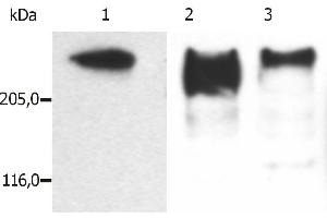 Western Blotting analysis (reducing conditions) of microtubules partially purified from porcine brain lysate. (MAP2 抗体)