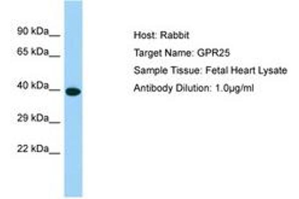 GPR25 抗体  (C-Term)