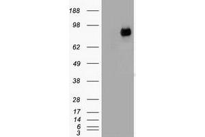 HEK293T cells were transfected with the pCMV6-ENTRY control (Left lane) or pCMV6-ENTRY CTNNB1 (Right lane) cDNA for 48 hrs and lysed. (CTNNB1 抗体  (AA 531-781))