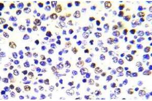 Immunohistochemistry analysis of Histone H3. (Histone H3.1 抗体)