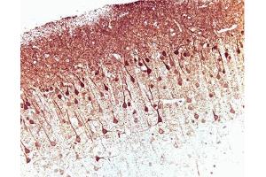 Immunohistochemical staining on a rat brain formalin-fixed paraffin-embedded section with citrate buffer pretreatment (20X magnification). (ERK (Pan) (AA 219-358) 抗体)