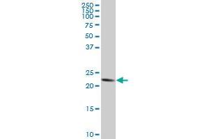 TRAPPC4 monoclonal antibody (M03), clone 2D5. (TRAPPC4 抗体  (AA 1-219))