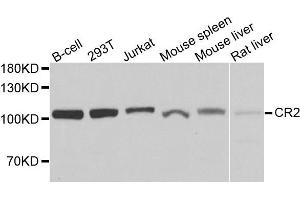 Western blot analysis of extracts of various cells, using CR2 antibody. (CD21 抗体)