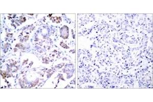 Immunohistochemistry (IHC) image for anti-Nuclear Factor-kB p65 (NFkBP65) (AA 221-270) antibody (ABIN2889039) (NF-kB p65 抗体  (AA 221-270))