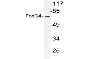Western blot (WB) analyzes of FoxO4 antibody in extracts from COLO205 cells. (FOXO4 抗体)