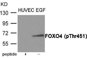 Western blot analysis of extracts from HUVEC cells treated with EGF using FOXO4 (Phospho-Thr451) Antibody. (FOXO4 抗体  (pThr451))