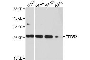 Western blot analysis of extracts of various cell lines, using TPD52 antibody. (TPD52 抗体  (AA 1-184))