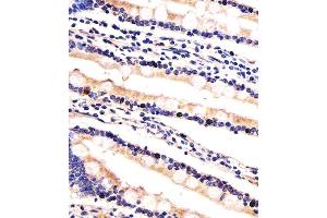 Immunohistochemical analysis of paraffin-embedded H. (UBE2K 抗体  (AA 109-139))