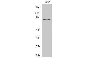 Western Blotting (WB) image for anti-Tyrosinase (TYR) (C-Term) antibody (ABIN3177845) (TYR 抗体  (C-Term))