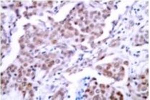 Image no. 2 for anti-Tumor Protein P53 (TP53) (pSer15) antibody (ABIN318091) (p53 抗体  (pSer15))