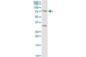 PRKCH MaxPab rabbit polyclonal antibody. (PKC eta 抗体  (AA 1-683))