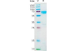 Human M-CSF Protein, hFc Tag on SDS-PAGE under reducing condition. (M-CSF/CSF1 Protein (AA 33-255) (Fc Tag))