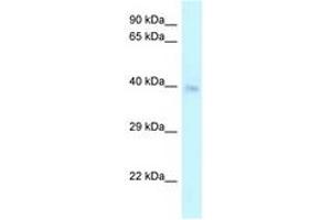 Image no. 1 for anti-Cysteine-Rich with EGF-Like Domains 2 (CRELD2) (C-Term) antibody (ABIN6747709) (CRELD2 抗体  (C-Term))