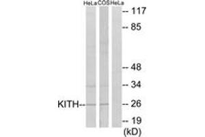 Western blot analysis of extracts from HeLa/COS7 cells, using KITH Antibody. (TK1 抗体  (AA 161-210))