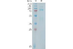 Human MET Protein, hFc Tag on SDS-PAGE under reducing condition. (c-MET Protein (AA 25-932) (Fc Tag))