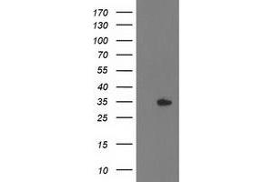 Western Blotting (WB) image for anti-Haloacid Dehalogenase-Like Hydrolase Domain Containing 2 (HDHD2) antibody (ABIN1498631) (HDHD2 抗体)