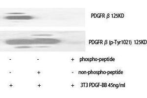 Western Blotting (WB) image for anti-Platelet Derived Growth Factor Receptor beta (PDGFRB) (pTyr1021) antibody (ABIN3173423) (PDGFRB 抗体  (pTyr1021))