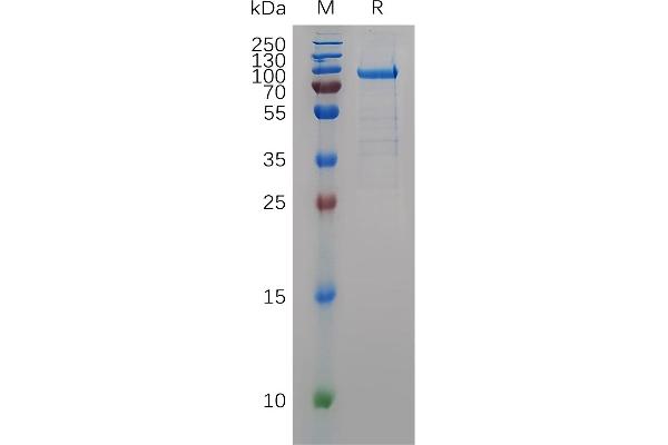 MMP11 Protein (AA 32-488) (Fc Tag)