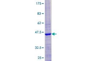 Image no. 1 for Myosin IH (MYO1H) (AA 1-127) protein (GST tag) (ABIN1311818) (Myosin IH Protein (MYO1H) (AA 1-127) (GST tag))