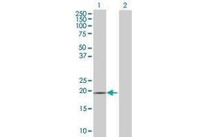 Lane 1: AGTRAP transfected lysate ( 16. (AGTRAP 293T Cell Transient Overexpression Lysate(Denatured))