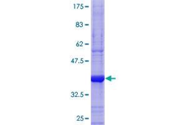 CA6 Protein (AA 209-308) (GST tag)