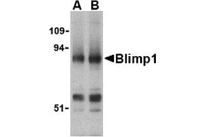Image no. 1 for anti-PR Domain Containing 1, with ZNF Domain (PRDM1) (N-Term) antibody (ABIN200138) (PRDM1 抗体  (N-Term))