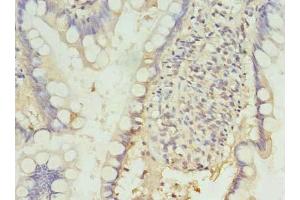 Immunohistochemistry of paraffin-embedded human small intestine tissue using ABIN7164683 at dilution of 1:100 (PD-1 抗体  (AA 21-170))