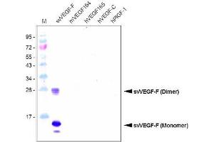 Western Blot Analysis using a Protein-A purified antibody against svVEGF-F (Bothrops Insularis). (VEGF-F / SvVEGF (AA 24-146) 抗体)