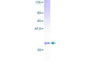 RPS27 Protein (AA 1-84) (GST tag)