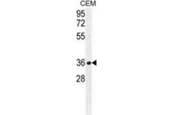 NUDT22 抗体  (C-Term)