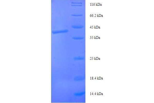 Syntaxin 10 Protein (STX10) (AA 2-228) (His-SUMO Tag)