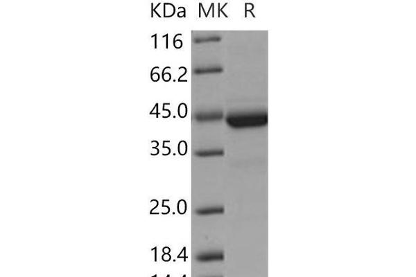 CST7 Protein (Fc Tag)