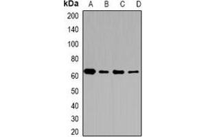 Western blot analysis of CD36 expression in MCF7 (A), A431 (B), mouse brain (C), mouse lung (D) whole cell lysates. (CD36 抗体)