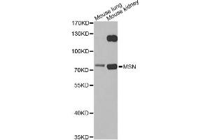 Western blot analysis of extracts of various cell lines, using MSN antibody. (Moesin 抗体)