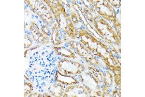 Immunohistochemistry of paraffin-embedded mouse kidney using MSP/MST1 Rabbit mAb (ABIN1680891, ABIN1680890, ABIN3015057 and ABIN3015058) at dilution of 1:100 (40x lens). (MST1 抗体)