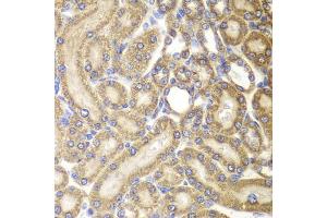 Immunohistochemistry of paraffin-embedded rat kidney using HSPD1 antibody (ABIN5970357) at dilution of 1/100 (40x lens). (HSPD1 抗体)